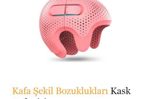 Kafatası şekil bozukluğu nedir?