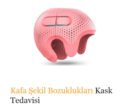 Kafatası şekil bozukluğu nedir?