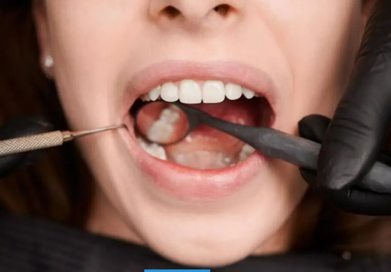 İstanbul İmplant Fiyatları Ne Kadar?